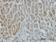 H00000165-M01 - AEBP1 / ACLP