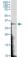 H00000166-D01 - AES / ESP1