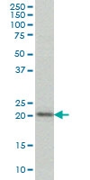 H00000166-M02 - AES / ESP1