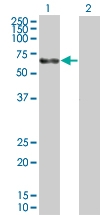 H00000174-B01 - Alpha-fetoprotein / AFP