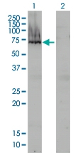 H00000174-M01 - Alpha-fetoprotein / AFP
