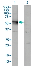 H00000183-M01 - Angiotensinogen
