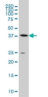 H00000191-M07A - AdoHcyase / AHCY