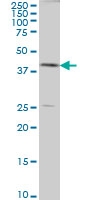 H00000191-M08A - AdoHcyase / AHCY