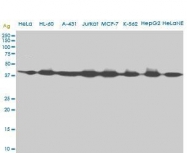 H00000191-M09 - AdoHcyase / AHCY