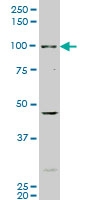H00000196-M02 - Ah receptor / AhR