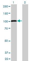 H00000196-M04 - Ah receptor / AhR