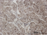 H00000196-M08 - Ah receptor / AhR