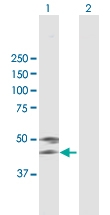 H00000197-B01 - Alpha-2-HS-glycoprotein / AHSG