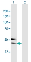 H00000197-B01P - Alpha-2-HS-glycoprotein / AHSG