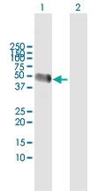 H00000197-D01 - Alpha-2-HS-glycoprotein / AHSG