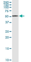 H00000197-D01 - Alpha-2-HS-glycoprotein / AHSG