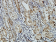 H00000207-M03 - AKT1 / PKB