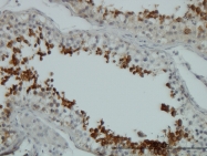 H00000207-M06 - AKT1 / PKB