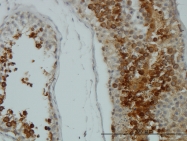 H00000207-M07 - AKT1 / PKB