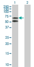 H00000213-D01P - Albumin
