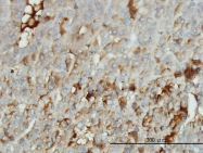 H00000213-M01 - Albumin