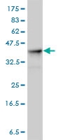 H00000226-M01 - Aldolase A / ALDOA