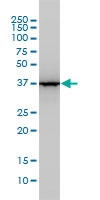 H00000226-M02 - Aldolase A / ALDOA