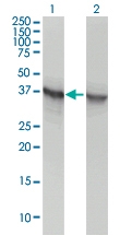 H00000226-M02 - Aldolase A / ALDOA