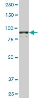 H00000271-M01A - AMP deaminase 2 / AMPD2