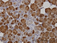 H00000276-M04 - Alpha-amylase 1 / AMY1