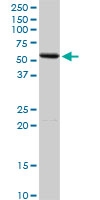 H00000279-D01P - Alpha-amylase 2A / AMY2A