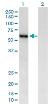 H00000280-B01P - Alpha-amylase 2B