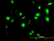 H00000301-B01P - Annexin A1 / ANXA1