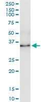 H00000301-D01 - Annexin A1 / ANXA1