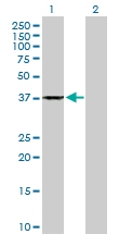 H00000301-D01P - Annexin A1 / ANXA1