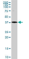 H00000301-D01P - Annexin A1 / ANXA1