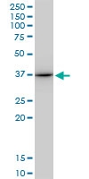 H00000301-M10 - Annexin A1 / ANXA1