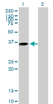 H00000301-M10 - Annexin A1 / ANXA1