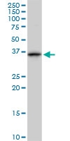 H00000301-M10 - Annexin A1 / ANXA1