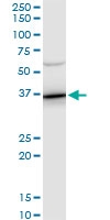 H00000302-A01 - Annexin A2 / ANXA2