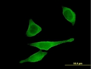 H00000302-B01 - Annexin A2 / ANXA2