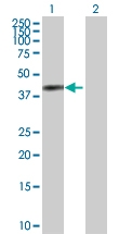 H00000302-D01P - Annexin A2 / ANXA2