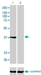 H00000302-M01 - Annexin A2 / ANXA2
