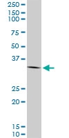 H00000302-M08 - Annexin A2 / ANXA2
