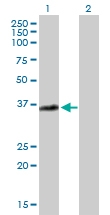 H00000306-B01P - Annexin A3 / ANXA3