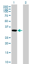 H00000306-D01P - Annexin A3 / ANXA3