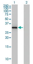 H00000306-M12 - Annexin A3 / ANXA3