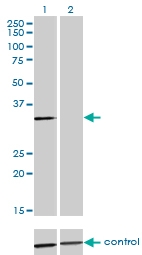 H00000306-M12 - Annexin A3 / ANXA3