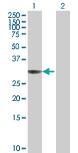 H00000307-B01P - Annexin A4 / ANXA4