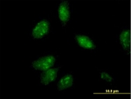 H00000307-B01P - Annexin A4 / ANXA4