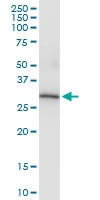 H00000307-D01 - Annexin A4 / ANXA4