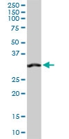 H00000307-D01P - Annexin A4 / ANXA4