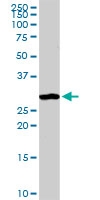 H00000307-D01P - Annexin A4 / ANXA4