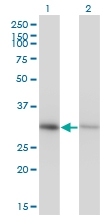 H00000307-M13 - Annexin A4 / ANXA4